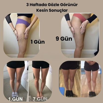 Selu-Fit Selülit Giderici Masaj Aleti